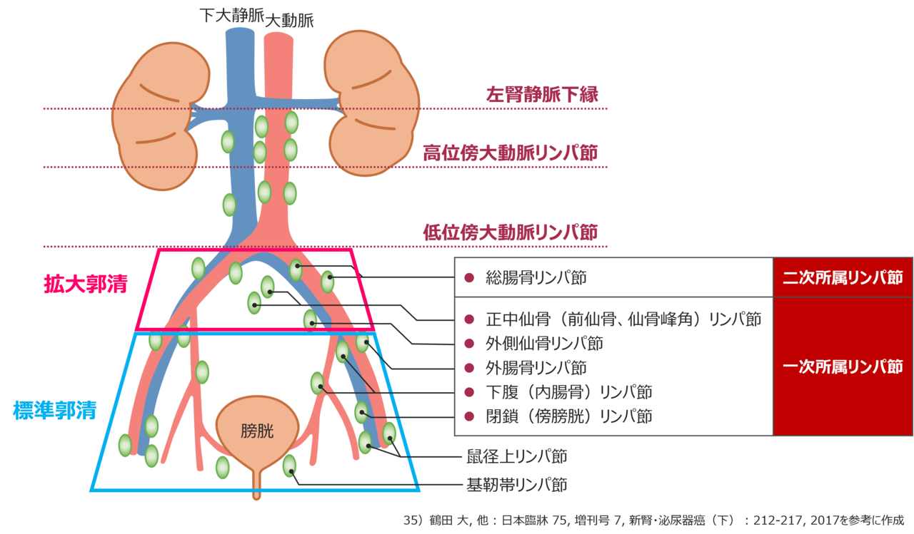 図3　膀胱全摘除術時における骨盤リンパ節郭清範囲